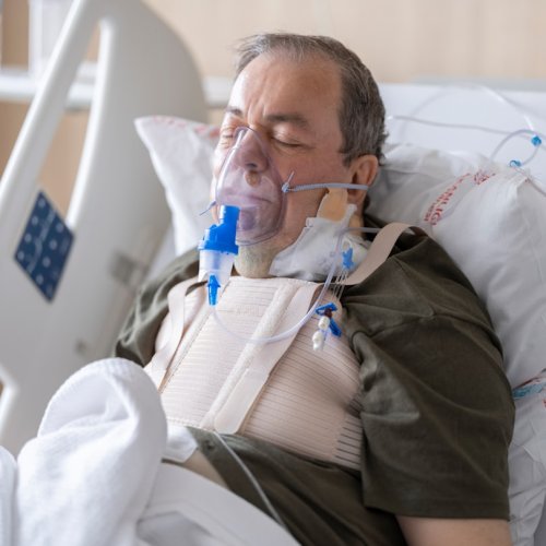 Побічні ефекти апарату CPAP: сухість рота, аерофагія та інші
