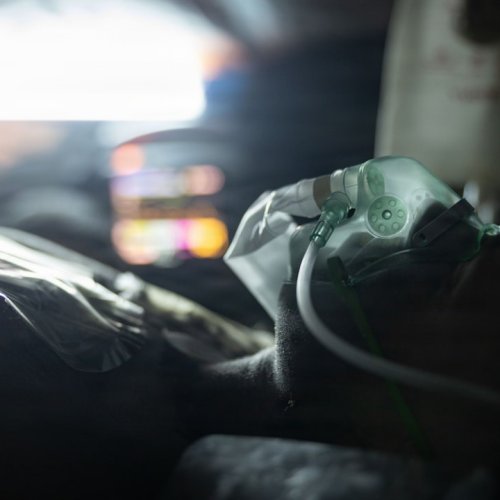 Як чистити апарат CPAP: повна інструкція для користувачів