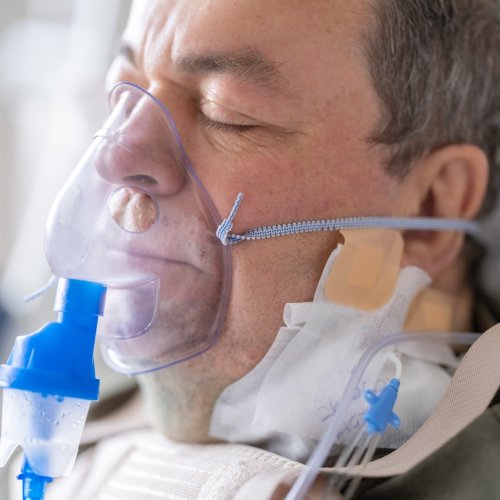 Як вибрати маску CPAP на основі позиції сну